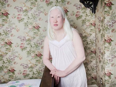 albino people naked|Albino Girls Porn Pics & Naked Photos .